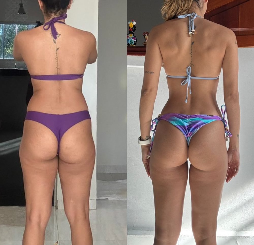 Antes e depois de aluna de costas, acompanhada pela treinadora Thallita Moura